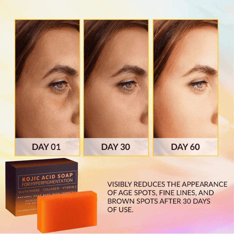 SAUVASINE Kojic Acid Soap